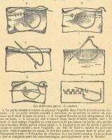 Citation block thumbnail